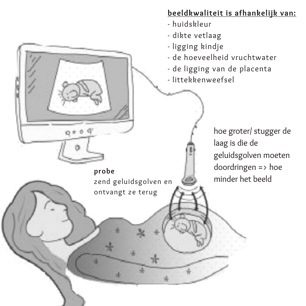 Een 2D echo maken: hoe werkt het?